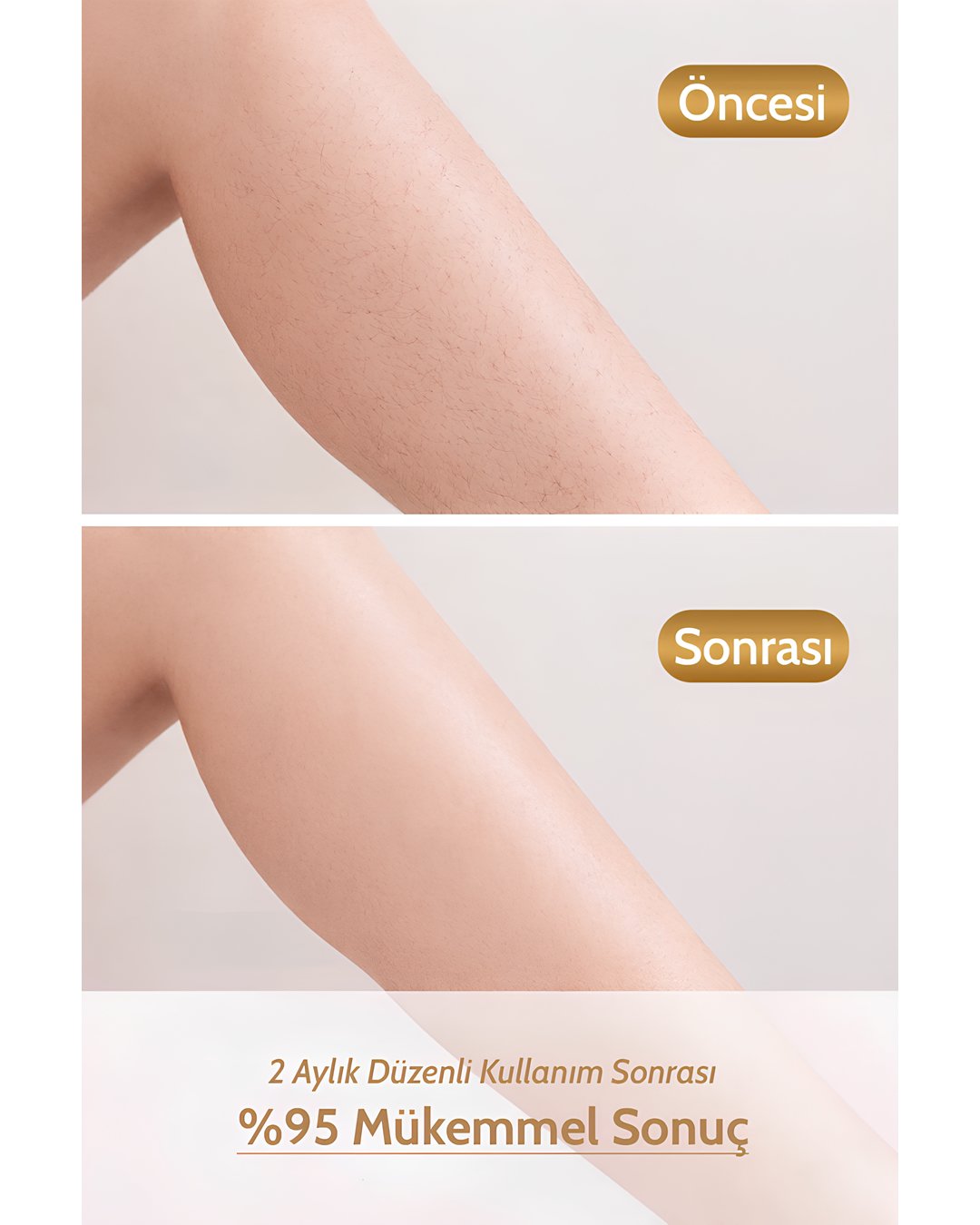 GoldMi IPL01 Buz Lazer Epilasyon Cihazı 21J | Sınırsız Atım, ICE Soğutma, Cilt Gençleştirme özellikleri